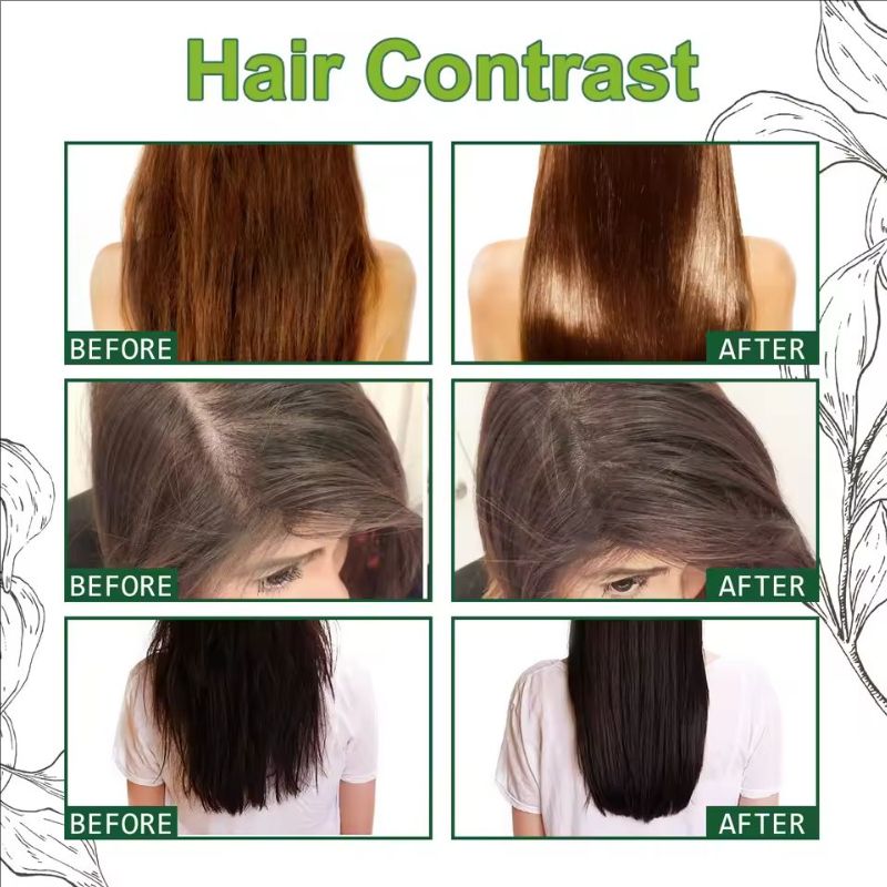 Fast Hair Growth Anti Alopecia Oil Ginger Essential High Hairline Head Hair Serum Hairless Baldhead Increase Essence Cream