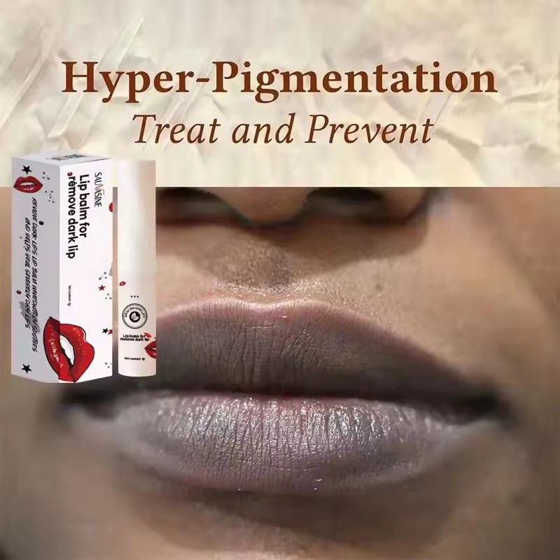 Lips Pink Fresh Lightening Bleaching Cream Treatment Remove Dark Smoke Lips Lip Balm Whitening Moisturizer Nourishing Essence