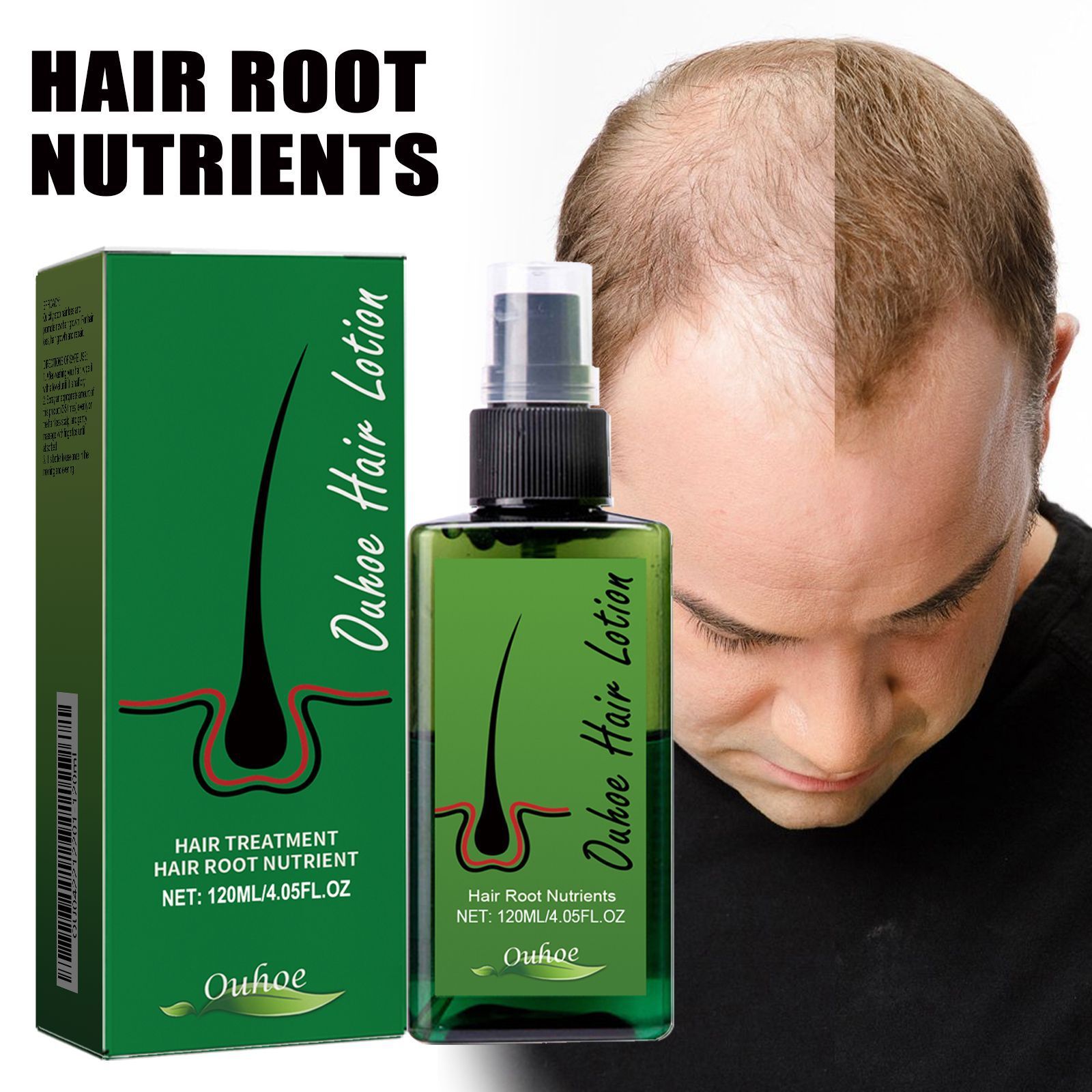 Hot Hair lotion Hair Growth Serum Essence Oil Hair Loss Treatment Growth Hair for Men Women Thailand Anti Hair Loss Spray