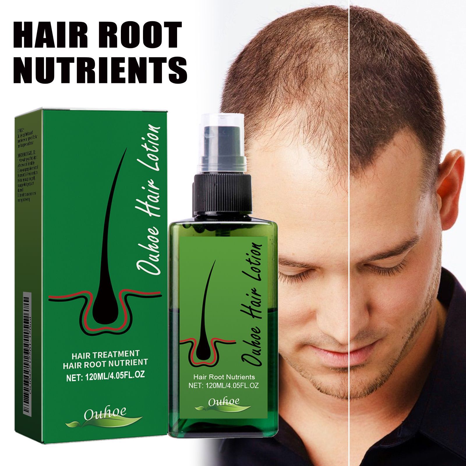 Hot Hair lotion Hair Growth Serum Essence Oil Hair Loss Treatment Growth Hair for Men Women Thailand Anti Hair Loss Spray