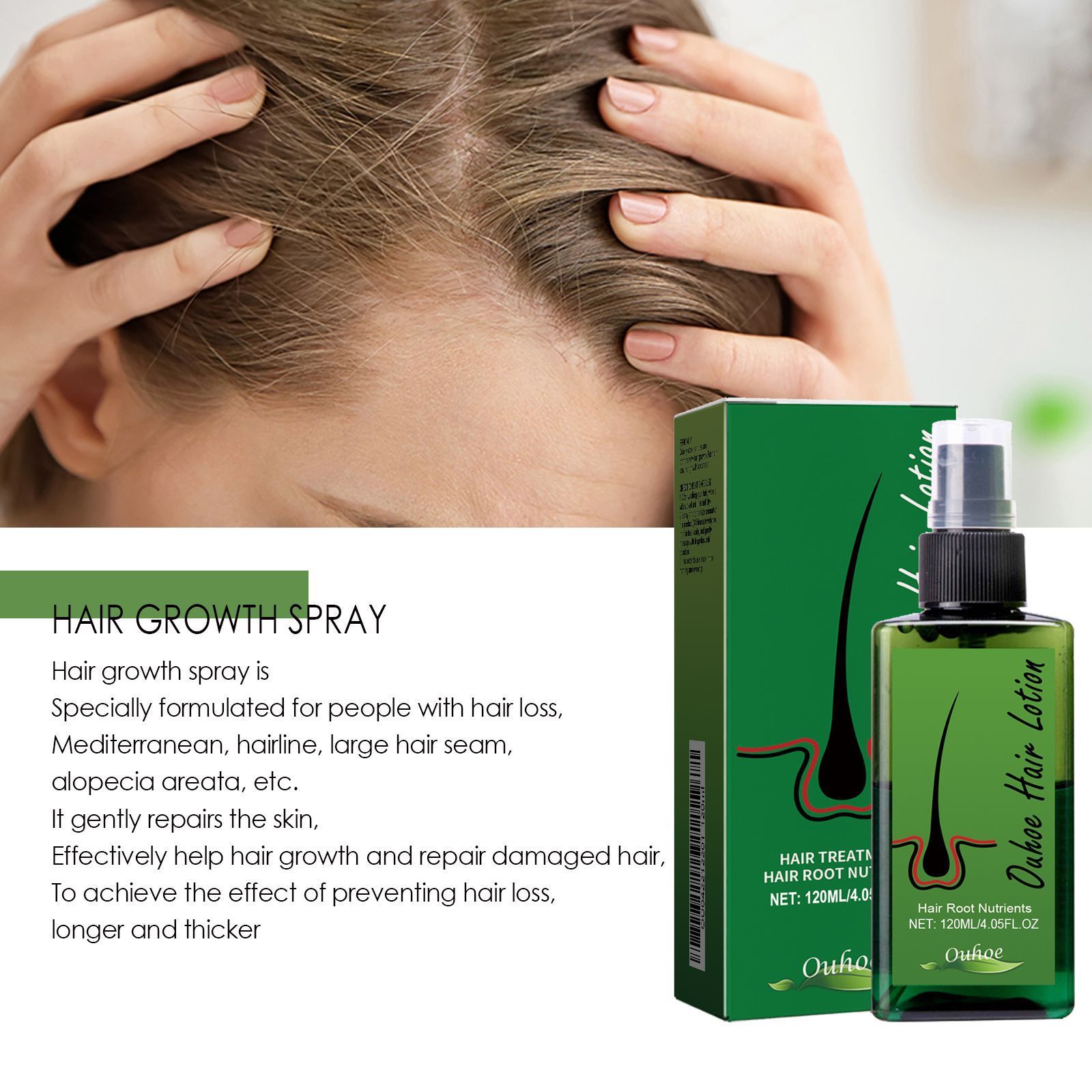 Hot Hair lotion Hair Growth Serum Essence Oil Hair Loss Treatment Growth Hair for Men Women Thailand Anti Hair Loss Spray