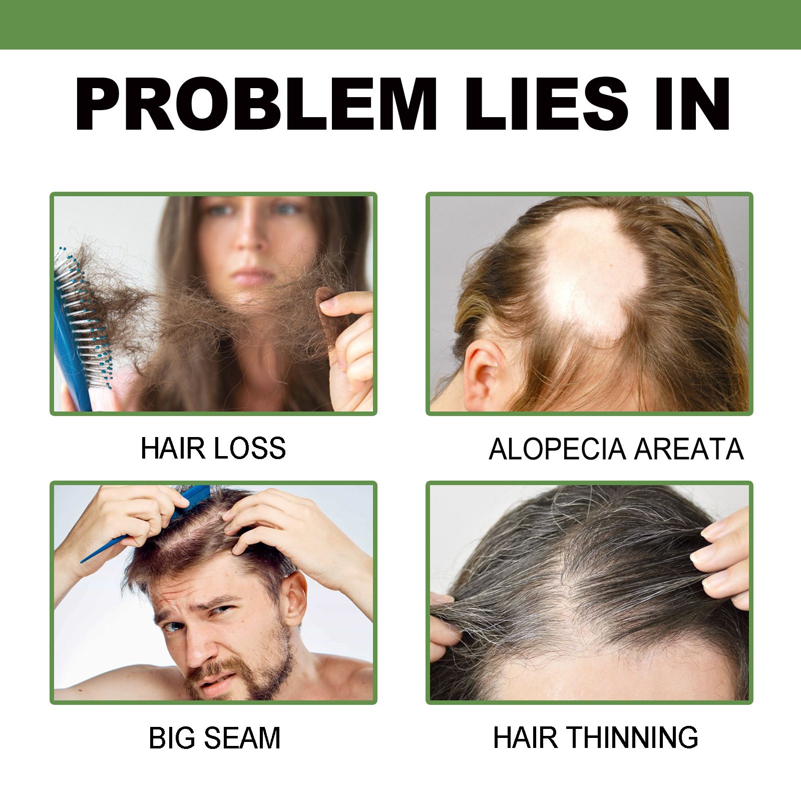 Hot Hair lotion Hair Growth Serum Essence Oil Hair Loss Treatment Growth Hair for Men Women Thailand Anti Hair Loss Spray