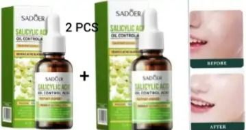 2 Piecs -Vitamin C Face Brightening Serum And Salicylic Acid Acne Treatment Essence, Control Face Oil and removes Blackheads, Brightens Face, Fades Black Spots, Moisturize Face, Anti Wrinkles