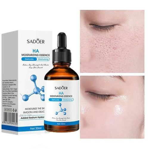 Sadoer 3 Pieces, Niacinamide Face Brightening Serum+ Hyaluronic Acid akin to Vitamin C+ Salicylic Acid Acne Treatment and Blackheads Remover, For Smooth , Hydrated, Moisturized Skin, with Oil Control
