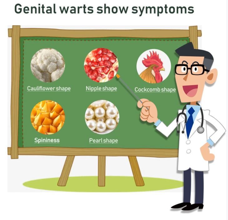 20g Genital Wart Herpes Remover Ointment Skin Tags Mole &amp; Papillomas Wart Remover Condyloma Acuminatum Treatment Cream