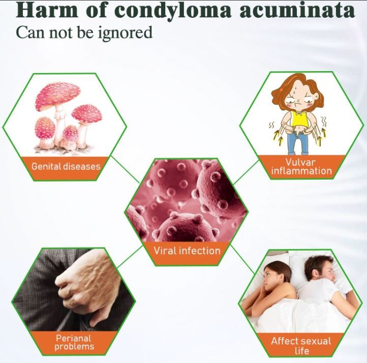 20g Genital Wart Herpes Remover Ointment Skin Tags Mole &amp; Papillomas Wart Remover Condyloma Acuminatum Treatment Cream