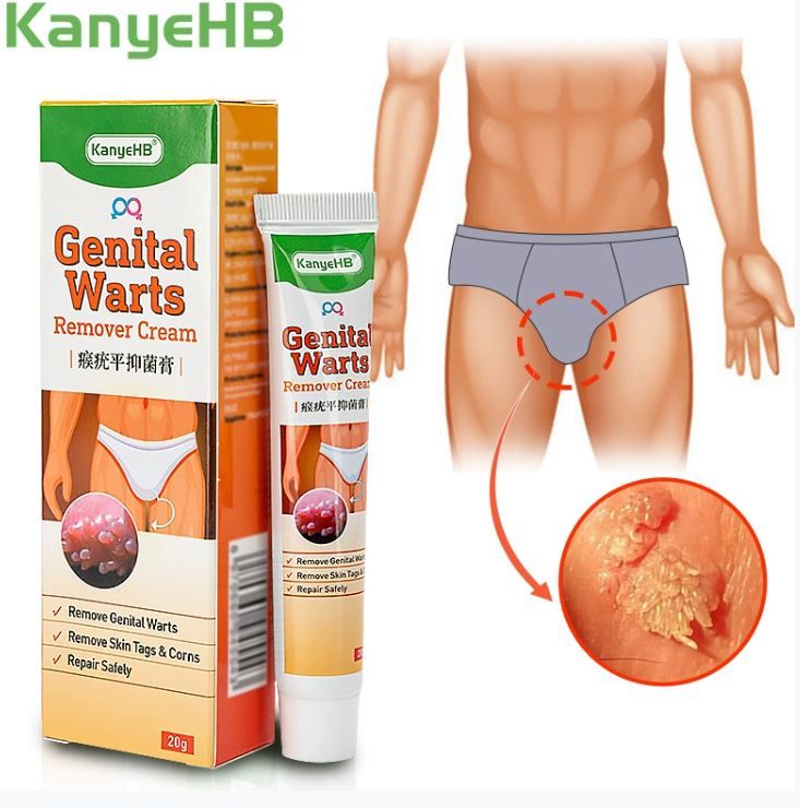 20g Genital Wart Herpes Remover Ointment Skin Tags Mole &amp; Papillomas Wart Remover Condyloma Acuminatum Treatment Cream