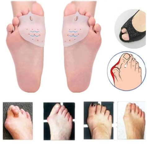 2pcs Silicone Toe Spreader Protection Pad Bunion Corrector
