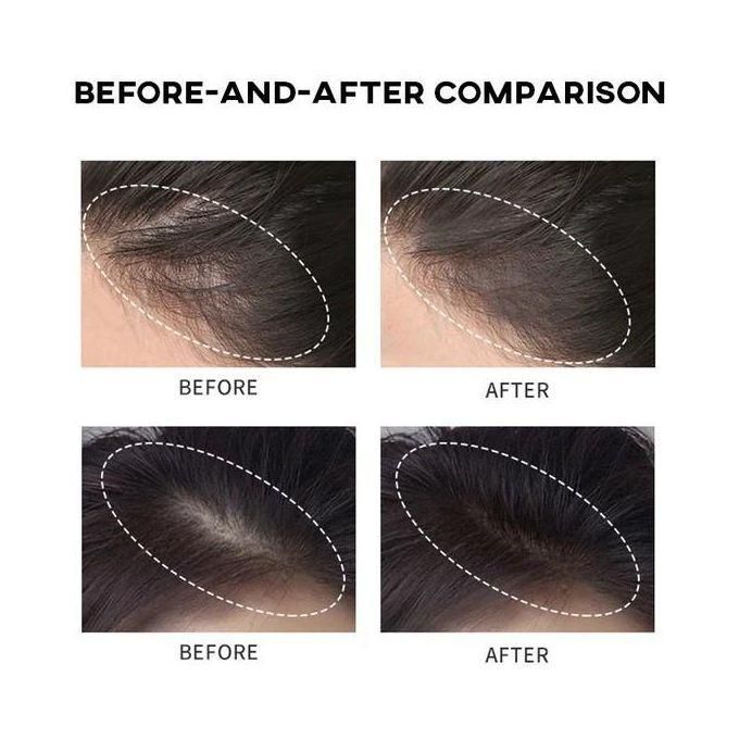 Hair Line Powder Black & Brown, Root Cover Up, Natural Instant Waterproof Hairline Shadow Powder, Hair Concealer, Scalp Cover, Bald Head Cover, Thinning Hair, Less Hair Cover