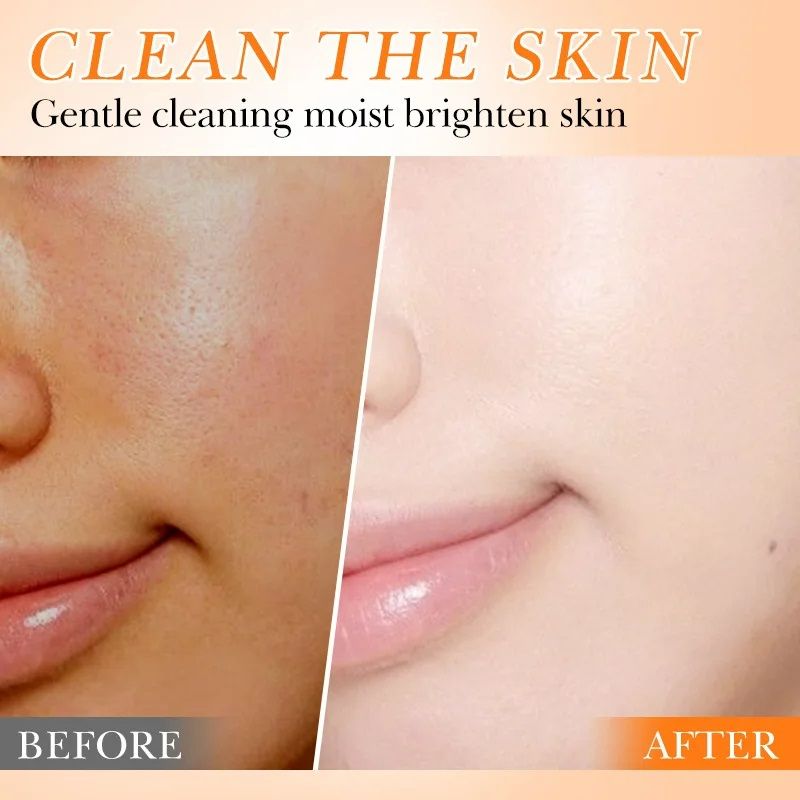 Vitamin C Facial Cleanser Face Wash Foam Cleanser Whitening Antioxidant Moist Brightening Skin Deep Cleansing Hydrating VC Skin Care Cleanser
