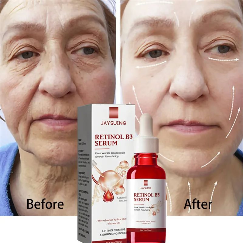 Retinol Facial Essence Wrinkle Remover Face Serum Instant Firming Anti-Aging Lifting Facial Cream Fade Fine Lines Serum Anti-Wrinkle Moisturizing Retinol Serum Face Neck Skin Care Serum