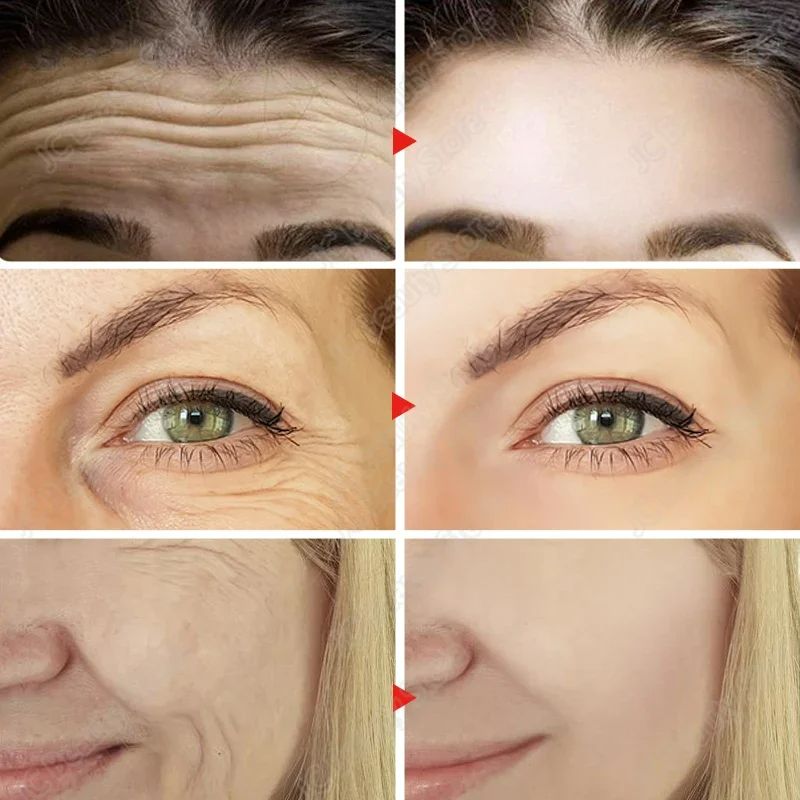 Retinol Facial Essence Wrinkle Remover Face Serum Instant Firming Anti-Aging Lifting Facial Cream Fade Fine Lines Serum Anti-Wrinkle Moisturizing Retinol Serum Face Neck Skin Care Serum