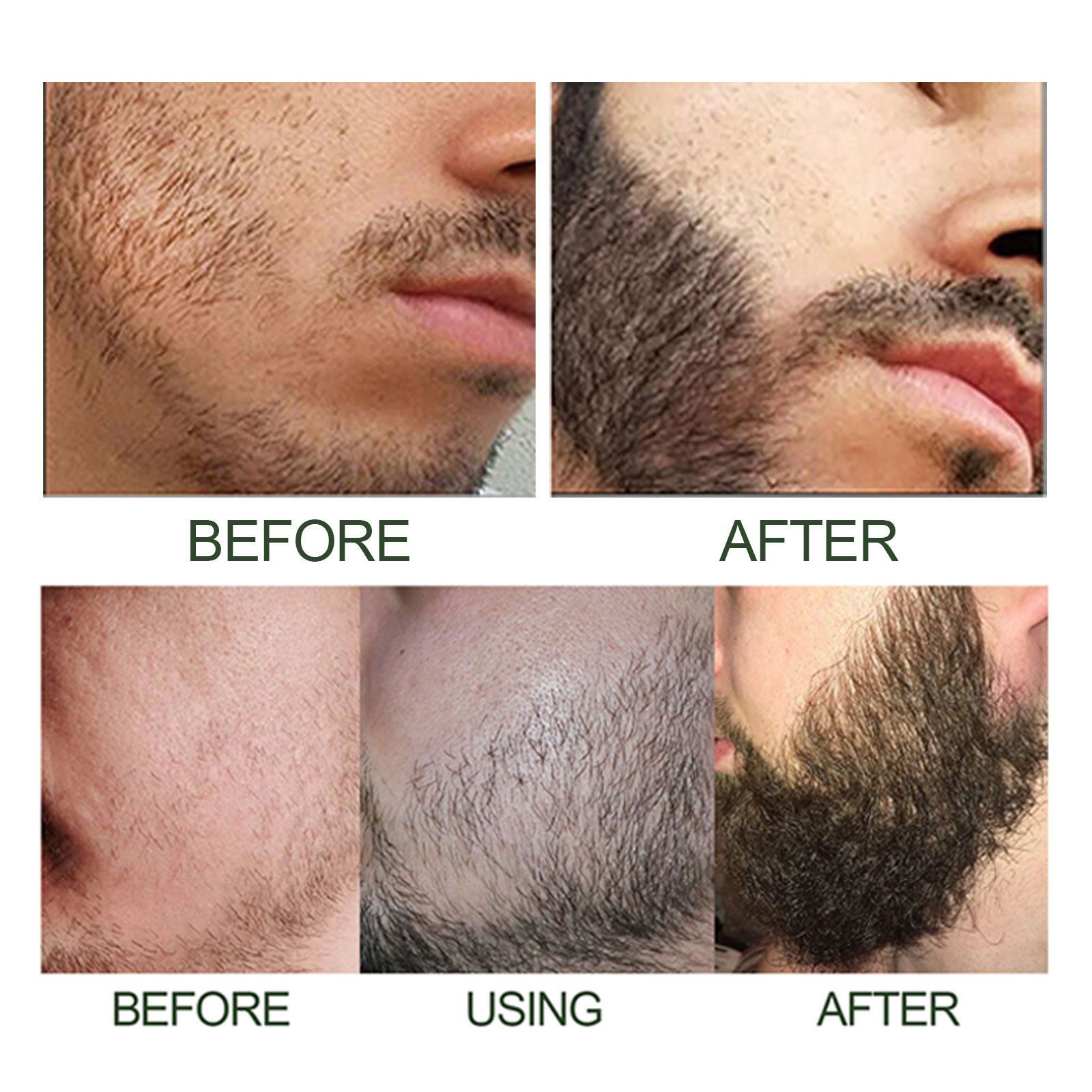 Men's Beard Growth Serum Kit With Derma Roller Stronger Thicker Fuller Beard Serum Set Facial Care Nourishing Thickening Beard Care Oil Set