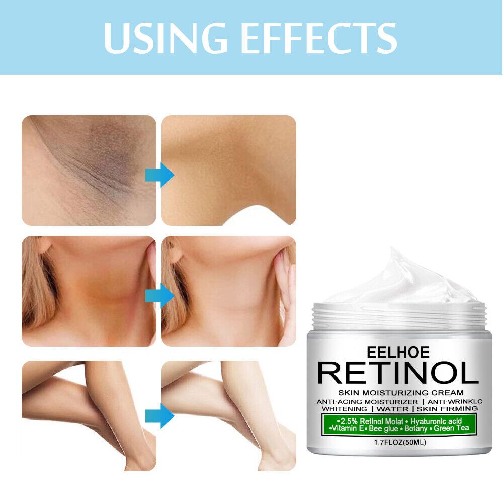 Retinol Body Whitening Cream Private Parts Underarm Inner Thigh Intimate Bleaching Serum Whiten Knee Butt Knuckles Brighten Cream