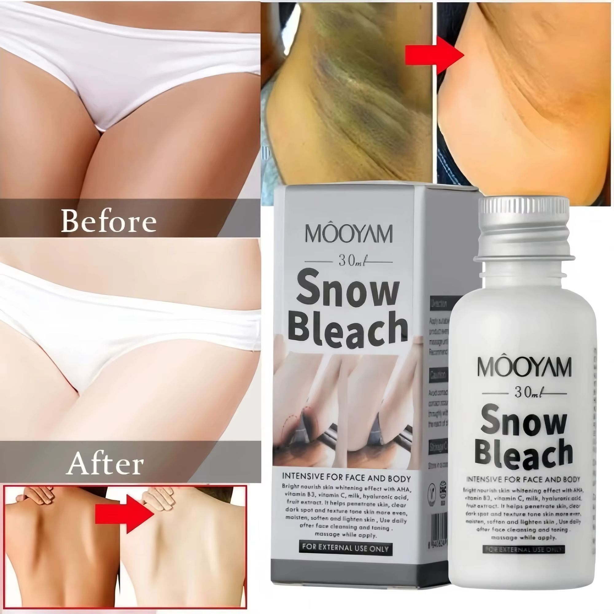 Snow Bleach Cream Body Whitening Cream Remove Thigh Inner Joint Dark Melanin Knee Bleach Private Part Whiten Lighten Moisturize Brighten Body Skin Care Bleaching Cream