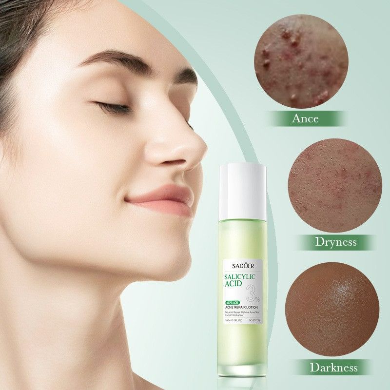 9PCS Salicylic Acid Dispel Acne Set Acne Repair Face Cream + Lighten Acne Marks Face Cleanser + Anti-Acne Repair Toner + Acne Removal Face Serum + 5PCS Acne Sooth Repair Hydrate Facial Masks