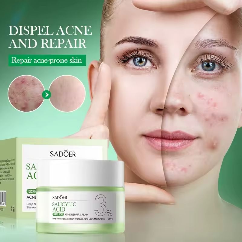 SADOER Salicylic Acid Acne Repair Face Cream Repair Pimple Spots Remove Black Head Pore Shrinking Oil Control Moisturizer Skin Care