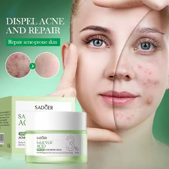 SADOER Salicylic Acid Acne Repair Face Cream Repair Pimple Spots Remove Black Head Pore Shrinking Oil Control Moisturizer Skin Care