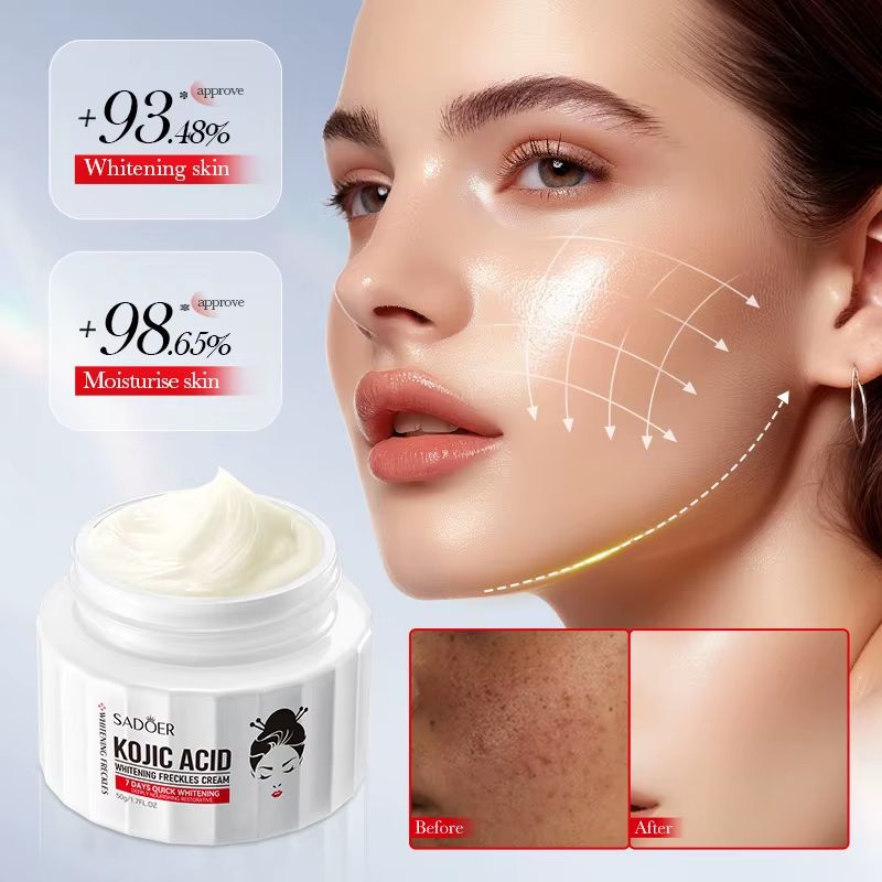 SADOER Kojic Acid Face Cream Remove Pigment Melanin Whitening Remove Dark Spots Cream Nourishing Brighten Moisturizing Freckle Removing Skin Care Face Cream