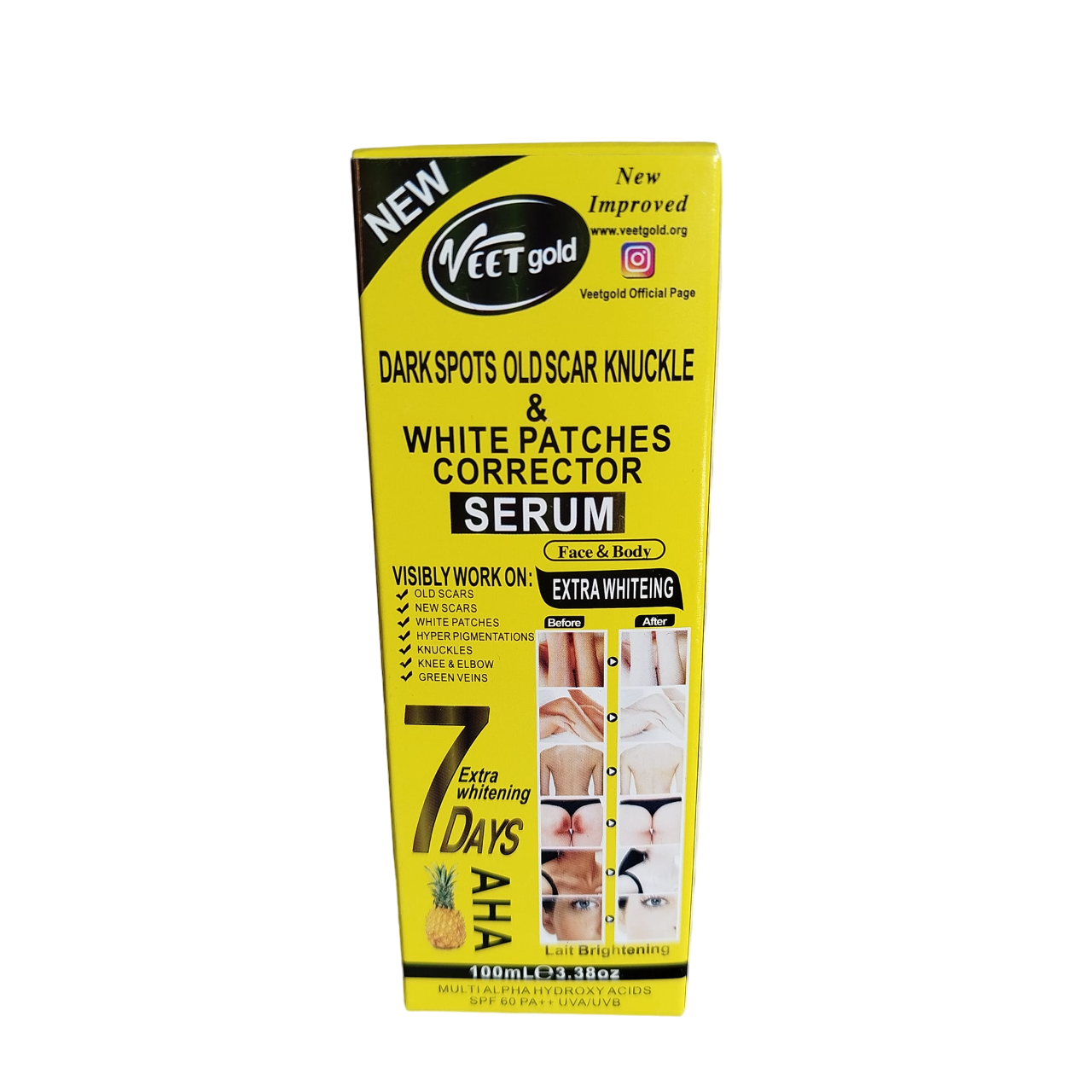Veet Gold AHA Face & Body Serum SPF 60. Removes Scars, Dark Spots, White Patches, Hyperpigmentations, Dark Knuckles, Green Veins, Dark Knee & Elbow, Moisturizes, Brightens, Smooths & Evens skin tone.