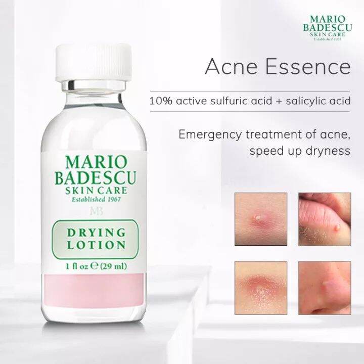 Mario Badescu Drying Lotion for Face with Salicylic Acid. Dry up & Remove Pimples, Blemishes, Acne, Spots, Breakouts, Unclogs Pores, Reduce redness, Exfoliates & dry up surface blemishes overnight.