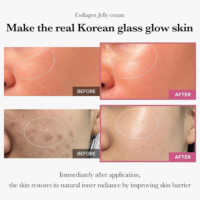 Anua 10% Niacinamide + TXA 4% Dark Spot Correcting Serum + Medicube Collagen Jelly Cream with Niacinamide. Moisturizes, Glows, Brighten, Removes Dark Spots, Hyperpigmentations, Wrinkles, Firms & Evens