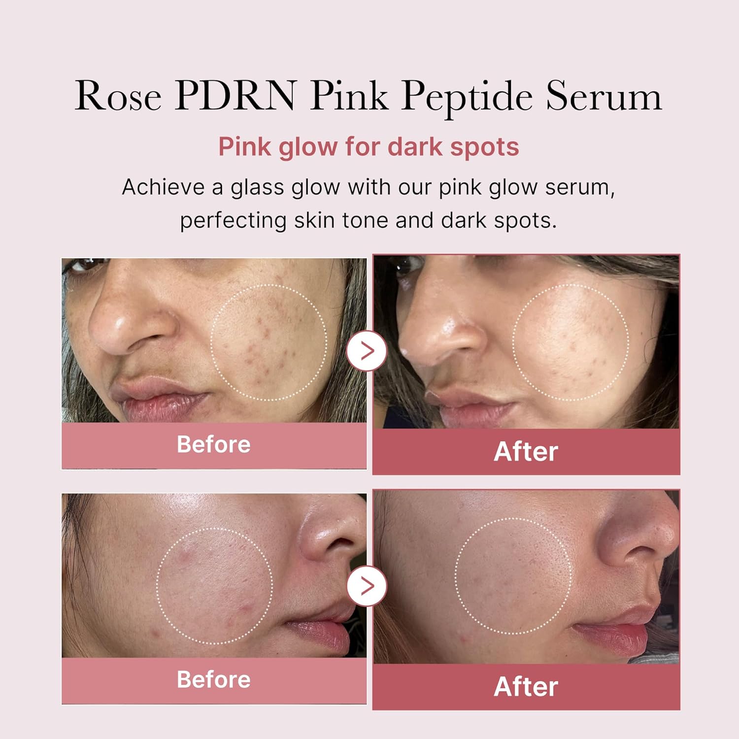 Anua 10% Niacinamide + TXA 4% Dark Spot Correcting Serum +  Medicube PDRN Serum with Niacinamide & Centella. Moisturizes, Fades Scars, Dark Spots, Wrinkles, Fine Lines, Glows, Repairs & Brightens