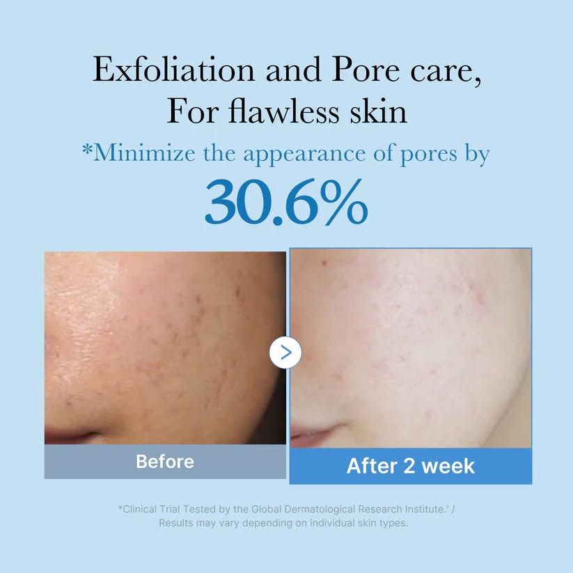 Medicube Zero Pore Toner with Niacinamide. Brighten dull skin, Exfoliates, slough away dead skin cells, reduces excess sebum, Minimizes pores, Smooths, Clarifies, Give a glass glow skin & Moisturizes