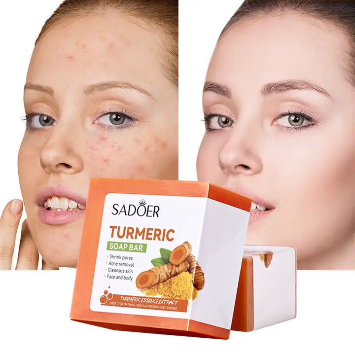 SADOER Turmeric  Anti-Acne Face & Body Soap - Deep Cleansing & Moisturizing, Dark Spot Corrector, Acne Scar Removal, Skin Repair & Brightening Bar (100g)