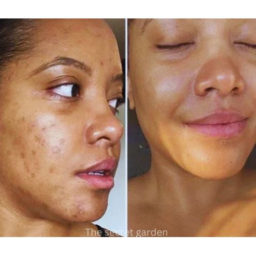 S Soft Tumeric Soap With Honey Soap