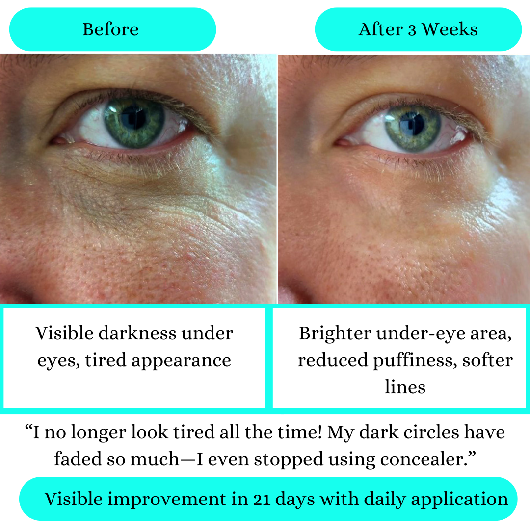 Dark Circles Serum - Minimize the look of puffiness and under-eye bags,Fragrance Free