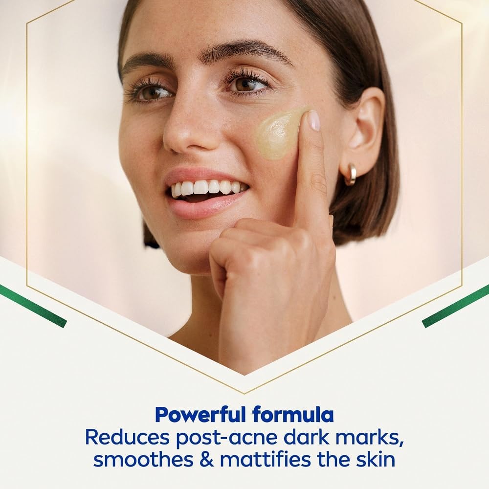 NIVEA Luminous 630 Post-Acne Dark Marks Serum (30ml), Facial Serum Visibly Reduces Post-Acne Dark Marks, Face Serum for Smooth, Refined, Glowing Skin Nivea Serum 30ml