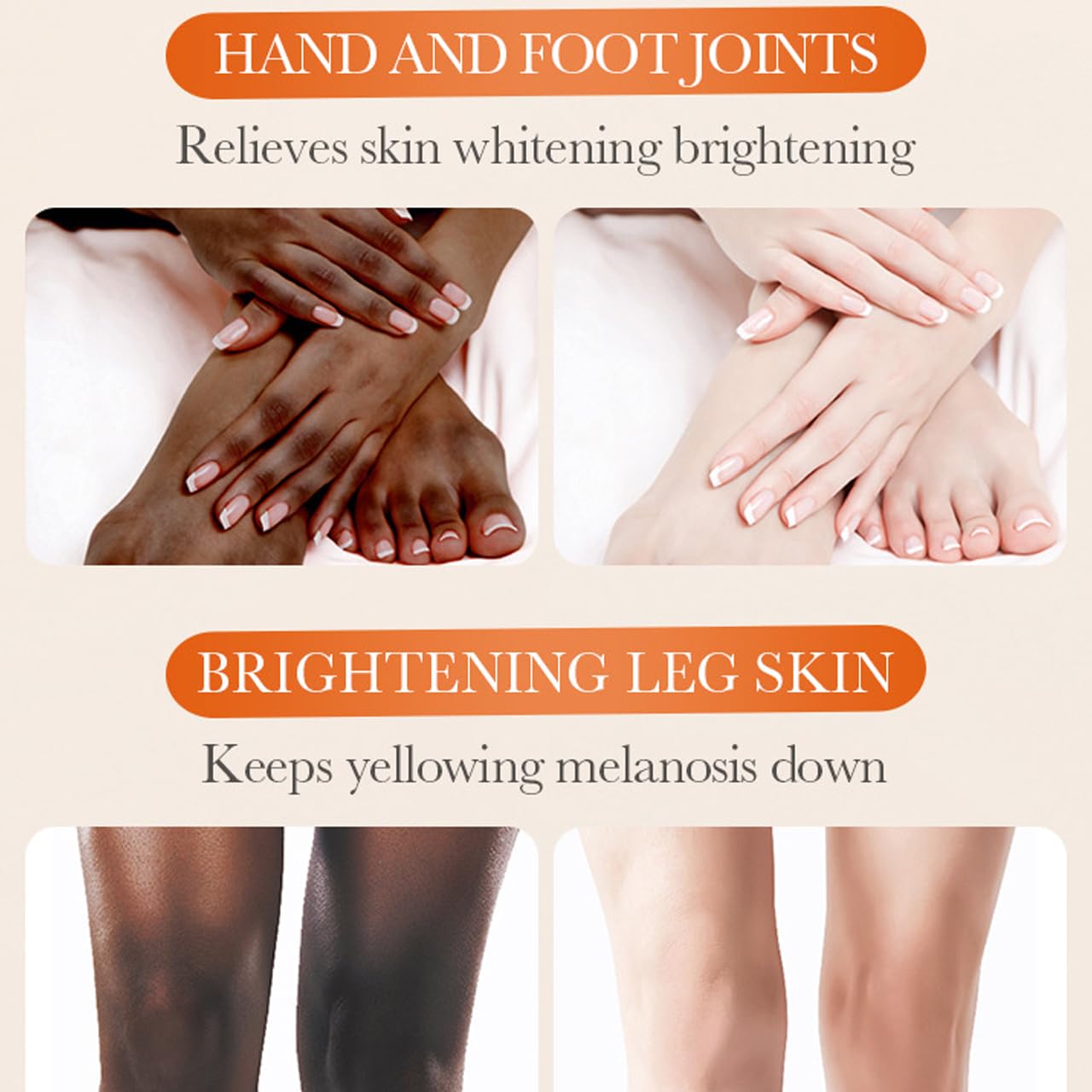 Sadoer Dark Knuckle Whitening Cream,Skin Body Bleaching For Dark Knees and Elbows,Moisturizing Strong Joint Whitening Cream for Clavicle,Neck,Niacinamide Vitamin C Dark Spot Corrector Remover