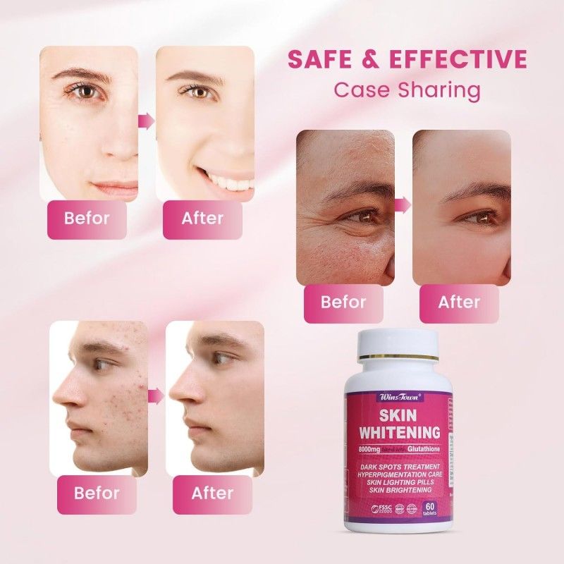 Daynee Skin Whitening - Clears Dark Spot Glutathione Whitening - Dark Spots & Acne Scar Remover - 5000g - Made in USA - Vegan Skin with Anti-Aging & Antioxidant Effect