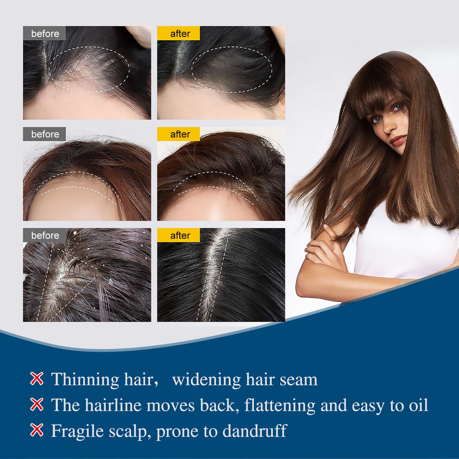 Jayswing hair ampoule essence lotion strong, nourishing and growing essence hair firming and strong hair root essence