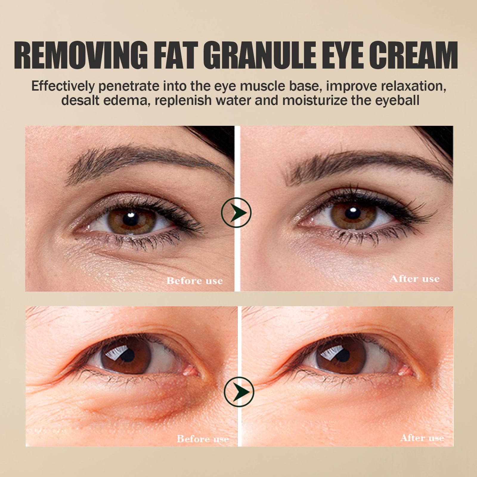 EELHOE eye cream improves fine lines around the eyes, tightens eye bags, moisturizes and locks in moisture, and is an eye care cream