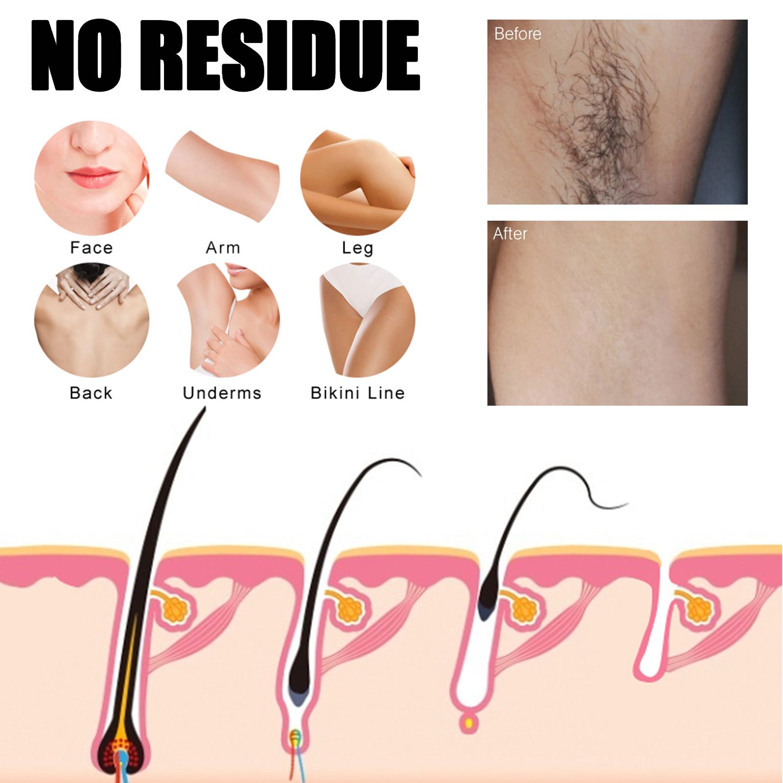 EELHOE Hair Removal Spray Underarm and Private Area Fast Hair Removal Gentle Hair Removal Spray, Mild, Refreshing, Non-Irritating