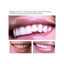 Lanthome White Foam Teeth Whitening Mousse ,Promotes optimal oral hygiene, whitening Mousse for effective teeth cleaning power for yellow teeth and stain removal, Unleash the brilliance of your smile.