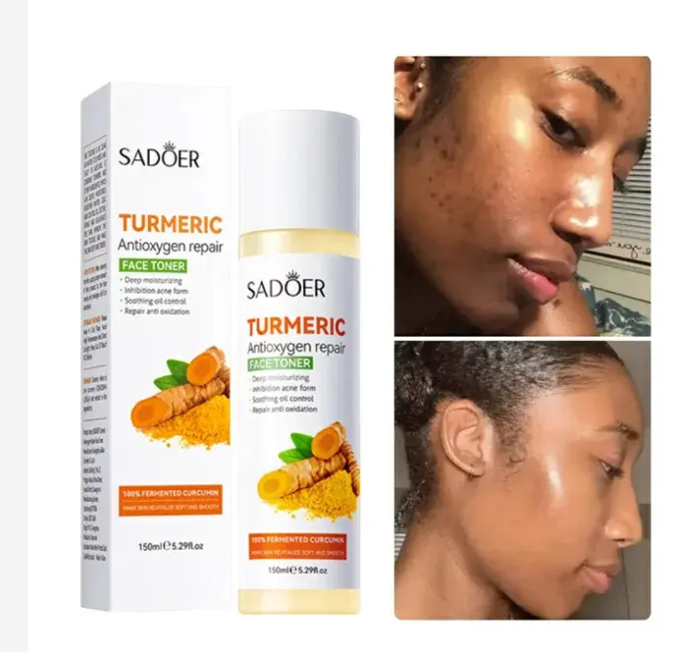 5 in 1 Sadoer Turmeric Set, Tumeric Cleanser + Face Serum +Face Toner + Face Cream + Tumeric Soap, with unparelled Vitamin C capabilities, Helps in Preven Acne, Sooth, Hydrate, Lighjten Acne Marks