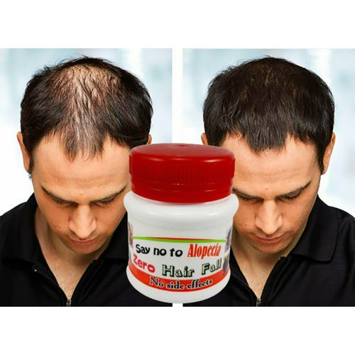 Zero Hair Fall Alopecia Fast Hair Growth Hairline Restore