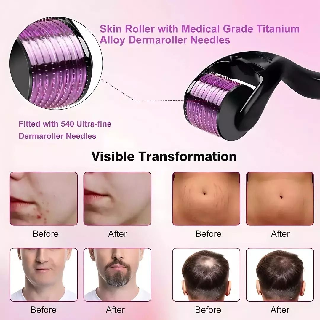 Derma Roller 0.5mm  540 Titanium Microneedle Roller for Face|Body|Beard Hair|scalp hair|youngskin|Acne Scars/ Wrinkles/ Anti Aging & patchy beards