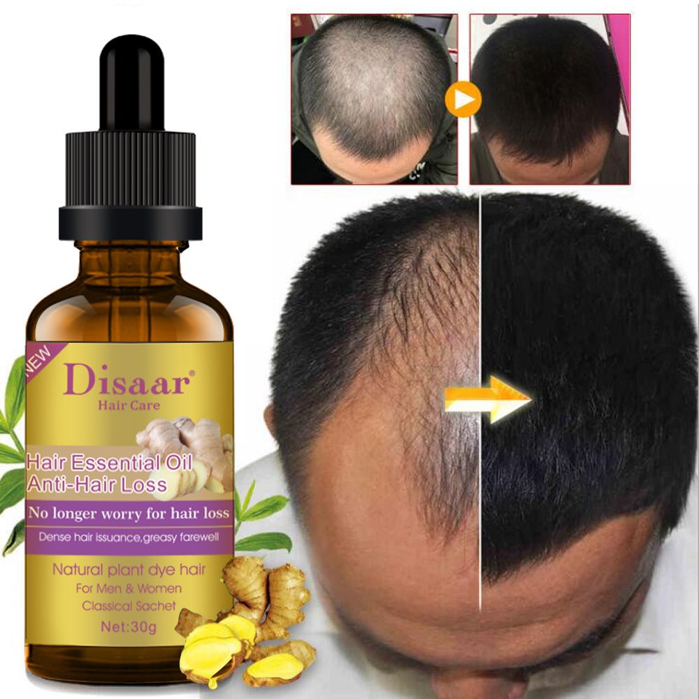 Hair Growth Essential Oil For Baldness, Hair Loss, Thinning & Scalp Repair With Natural Nutrients For Stronger, Fuller, Healthier Hair