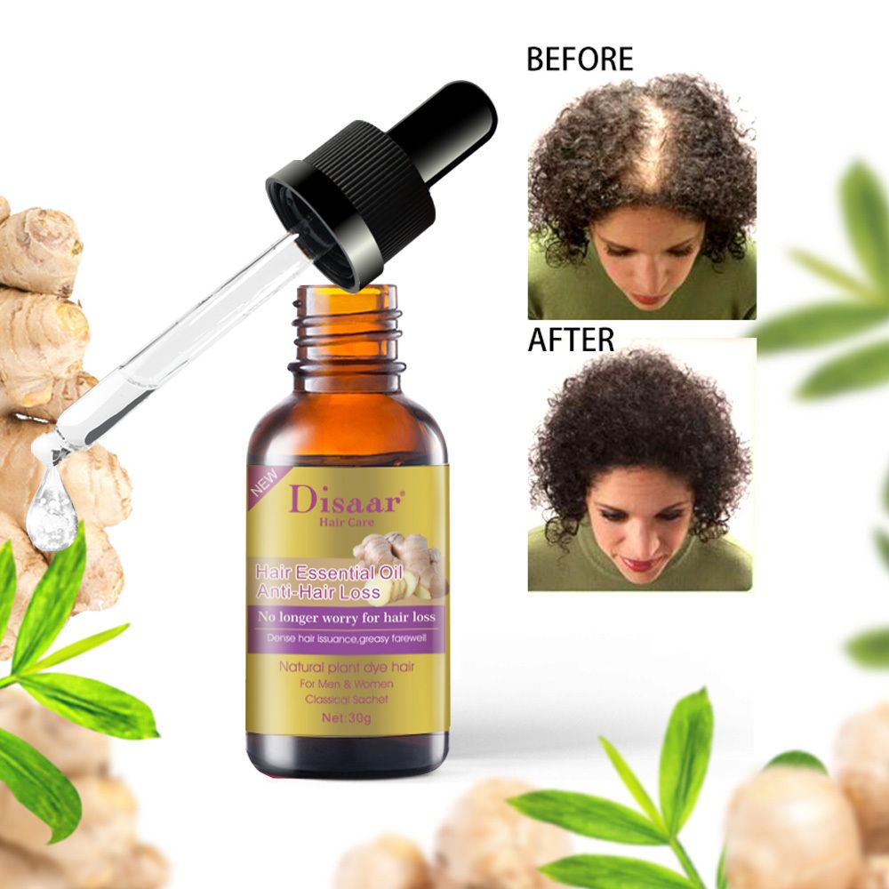 Hair Growth Essential Oil For Baldness, Hair Loss, Thinning & Scalp Repair With Natural Nutrients For Stronger, Fuller, Healthier Hair