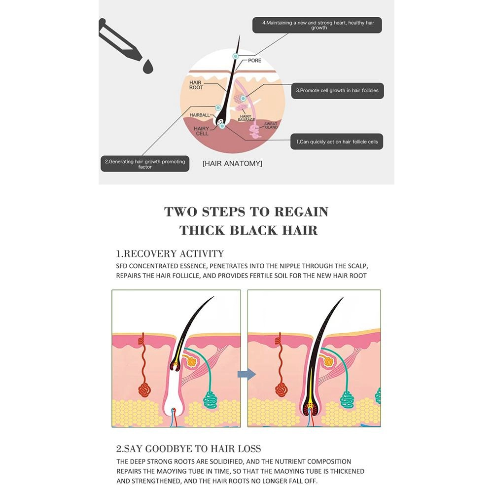 Hair Growth Essential Oil For Baldness, Hair Loss, Thinning & Scalp Repair With Natural Nutrients For Stronger, Fuller, Healthier Hair