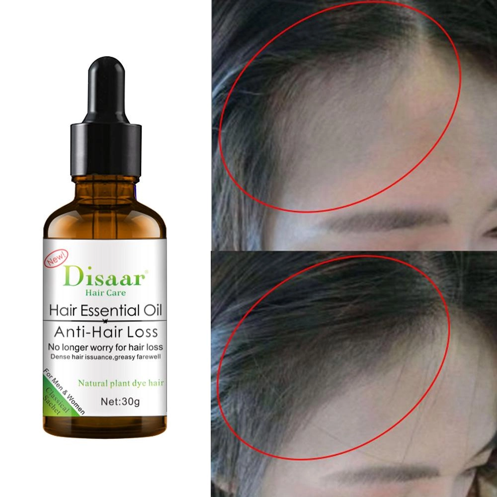Hair Growth Essential Oil For Baldness, Hair Loss, Thinning & Scalp Repair With Natural Nutrients For Stronger, Fuller, Healthier Hair