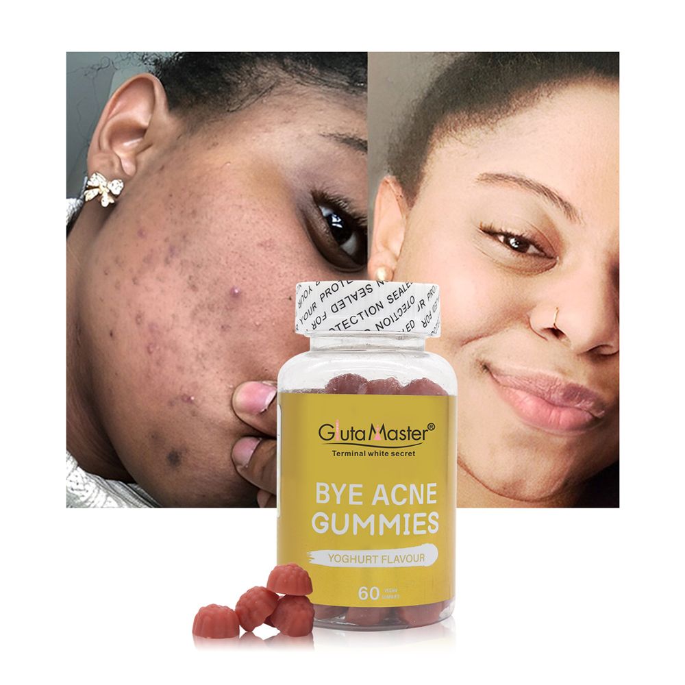 Gluta Master Bye Acne Gummies Clears Acne, Reduces Breakouts, Fades Dark Spots, Improves Skin Texture, Promotes Smooth Healthy Radiant And Glowing Skin From Within