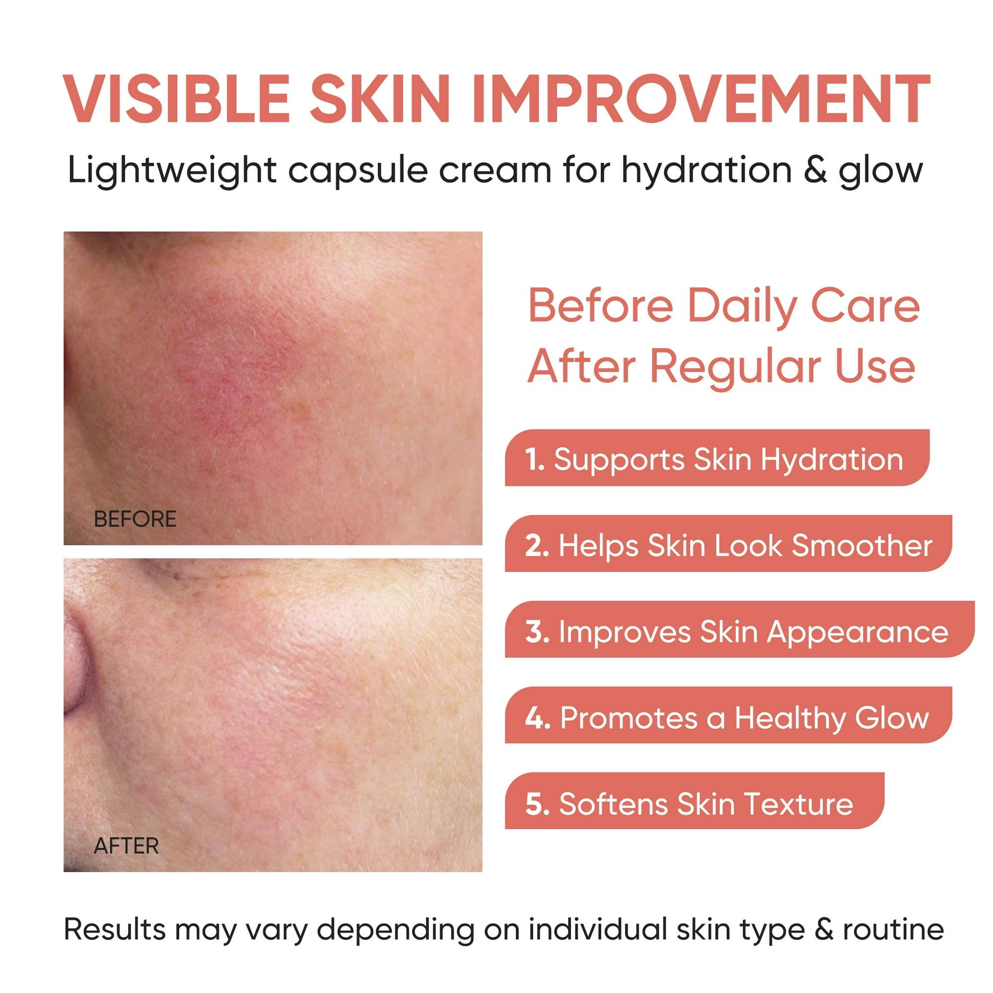 Pink Collagen Capsule Cream Face Moisturizer Lightweight Cream With Collagen Hyaluronic Acid And Niacinamide For Uneven Skin Tone Glow Radiant Hydration 140g