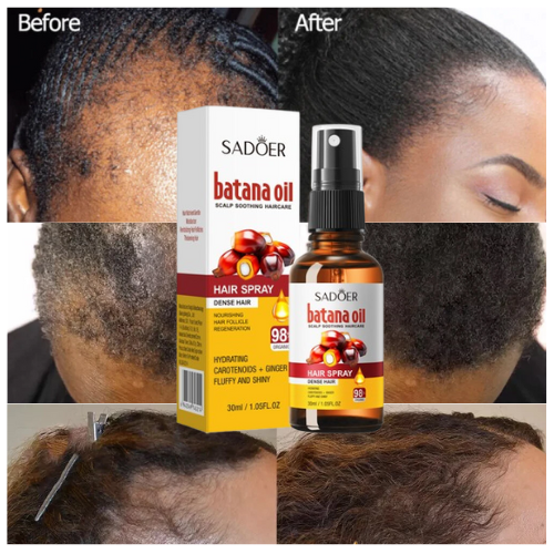 Sadoer Batana Oil Hair Spray 30ml Hair Growth & Scalp Care Treatment For Thicker, Fuller, Softer, And Healthier Hair Strengthens Roots, Reduces Hair Loss & Boosts Shine