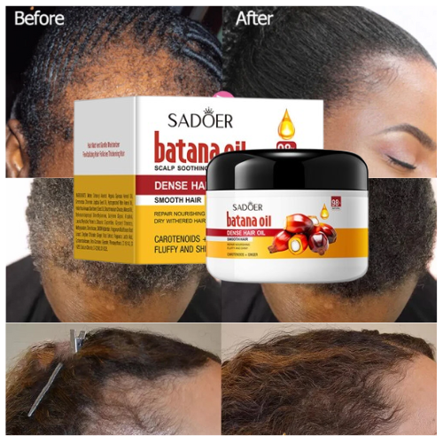 Sadoer Batana Oil Hair Growth Cream 100g Intensive Repair And Strengthening Formula For Thicker Fuller Softer Hair Strengthens Roots Reduces Breakage And Boosts Natural Shine