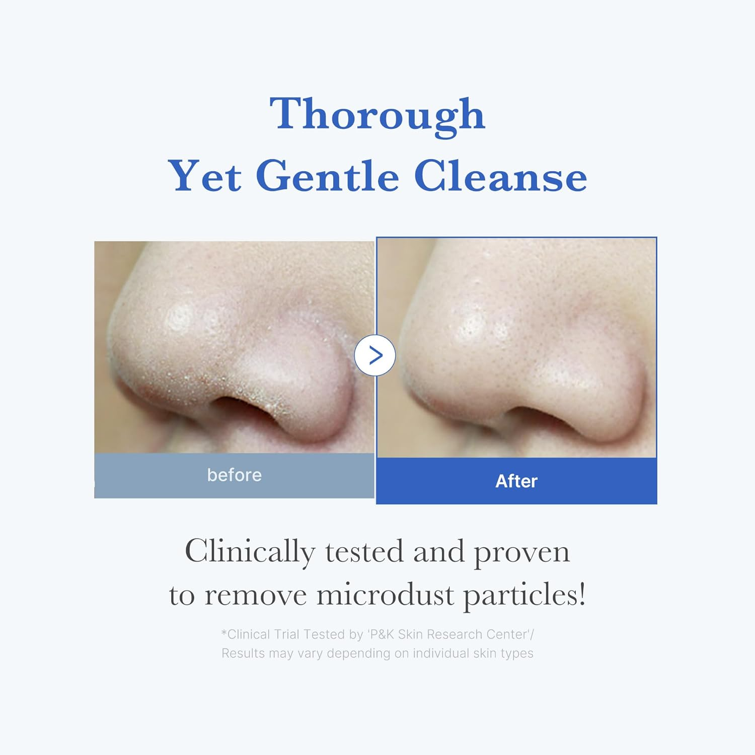 Medicube Zero Foam Cleanser For Sensitive Skin Sebum Control Moisture Balance And Pore Minimization Gentle Korean Cleanser That Controls Oil Balances Moisture And Minimizes Pores For Sensitive Skin